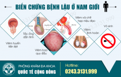 Bệnh lậu ở nam giới có nguy hiểm không và chữa thế nào?