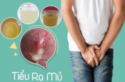 Cẩn thận với dấu hiệu tiểu ra mủ – Cảnh báo nhiều bệnh lý nguy hiểm