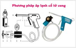 Chữa viêm lộ tuyến bằng phương pháp áp lạnh – Đã quá lỗi thời!