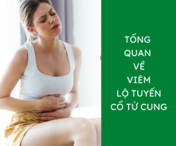 Tổng quan về viêm lộ tuyến cổ tử cung