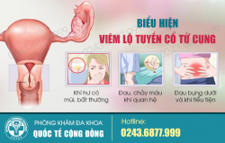 Cảnh giác với hiện tượng ra khí hư có mùi