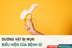 Chớ coi thường dấu hiệu mụn dương vật!