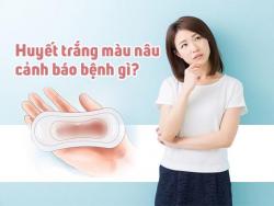 Khí hư màu nâu: Từ viêm nhiễm đến ung thư cổ tử cung