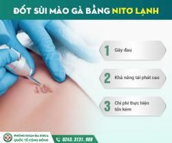 Đốt sùi mào gà là gì? Bao lâu thì khỏi, có nên đốt hay không?