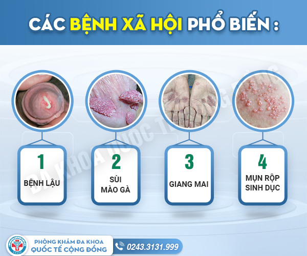 [Góc tư vấn] Xét nghiệm bệnh xã hội ở đâu chính xác? Địa chỉ nào đáng tin cậy?