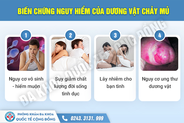 [Cảnh báo] Tình trạng dương vật chảy mủ vàng – xanh cần đến ngay cơ sở y tế