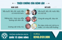 Tiểu buốt có mùi hôi – triệu chứng không thể chủ quan