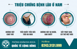 Cách điều trị bệnh lậu ở nam giới an toàn, hiệu quả